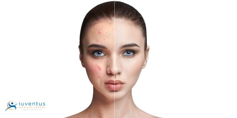 Enhances Skin Texture and Hydration