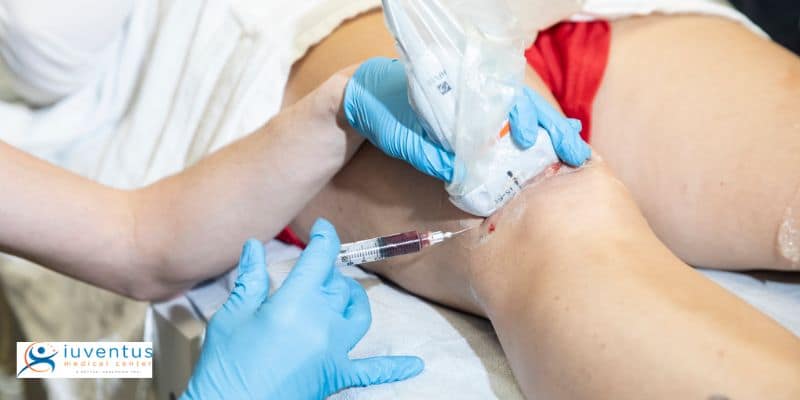 enefits of Stem Cell Therapy You Need to Know