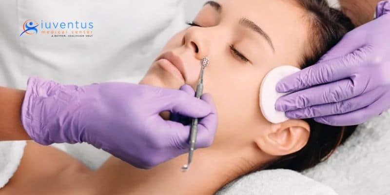 Deep Pore Cleaning and Extraction