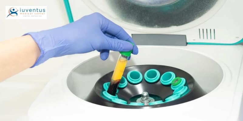 Preparing for PRP Therapy