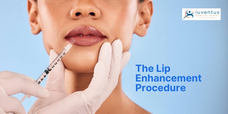 Lip Enhancement Procedure