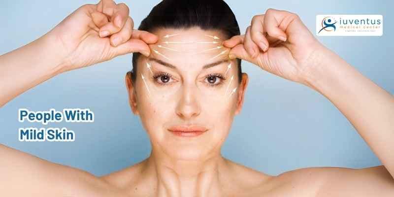 People With Mild Skin